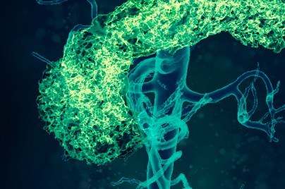Microscope image Pancreas and aorta, 3D CT scan