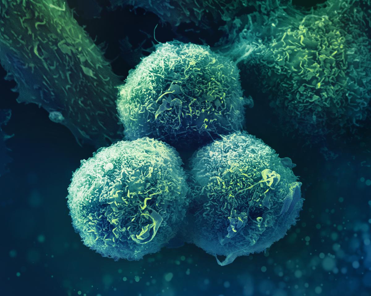 oncology