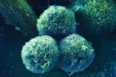 Microscope image Oncology